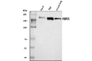 Western blot analysis of FKBP135/FKBP15 using anti-FKBP135/FKBP15 antibody (ABIN7600397).