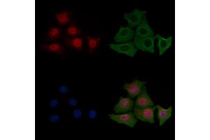 ABIN6255180 and ABIN6267443 staining HepG2 cells(4h of LPS treatment) by IF/ICC. (Cofilin anticorps  (pSer3))