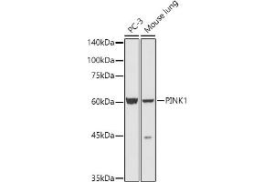 Western blot analysis of extracts of various cell lines, using PINK1 antibody (ABIN6128458, ABIN6145666, ABIN6145668 and ABIN6222945) at 1:500 dilution.