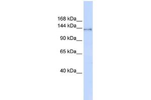 WB Suggested Anti-SUPT16H Antibody Titration:  0. (SUPT16H anticorps  (Middle Region))
