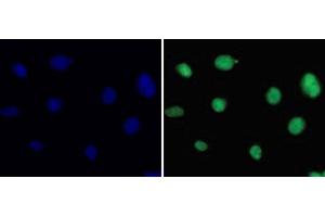 Immunofluorescence analysis of 293T cells using DiMethyl-Histone H3-K36 Polyclonal Antibody (Histone 3 anticorps  (2meLys36))