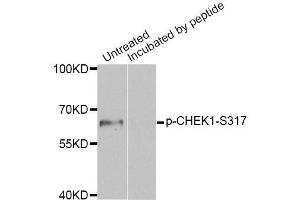 Western blot analysis of extracts of MCF7 cell line, using Phospho-CHEK1-S317 antibody (ABIN5969879). (CHEK1 anticorps  (pSer317))