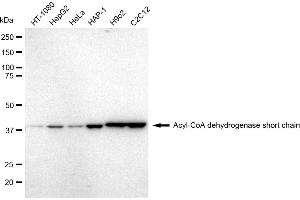 Western blotting analysis using Acyl-CoA dehydrogenase short chain antibody (ABIN7797493). (Recombinant Acyl Co-A Dehydrogenase (AIDB) (chain short) anticorps)