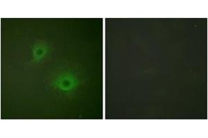 Immunofluorescence analysis of HuvEc cells, using EPHB1/2 (Ab-594/604) Antibody. (EPHB1/2 anticorps  (AA 561-610))