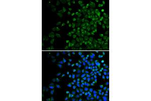 Immunofluorescence analysis of HeLa cells using BAK1 antibody. (BAK1 anticorps)