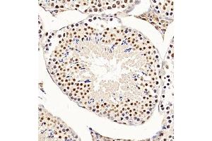 Immunohistochemistry of paraffin embedded mouse testis using CHD1L (ABIN7073491) at dilution of 1:650 (300x lens)