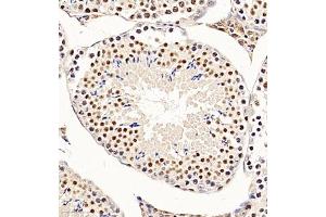 Immunohistochemistry of paraffin embedded mouse testis using CHD1L (ABIN7073491) at dilution of 1:650 (300x lens) (CHD1L anticorps)