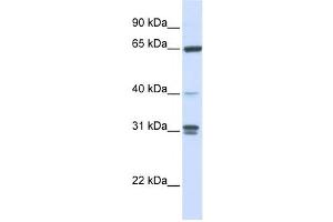 Western Blotting (WB) image for anti-Guanylate Binding Protein 2, Interferon-Inducible (GBP2) antibody (ABIN2459799) (GBP2 anticorps)