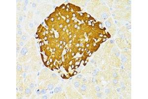 Immunohistochemistry of paraffin-embedded Mouse pancreatic islets using DDIT3 / CHOP Polyclonal Antibody at dilution of 1:100 (40x lens). (DDIT3 anticorps)