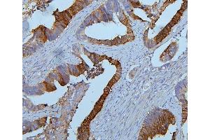 IHC analysis of PYROXD1 using anti-PYROXD1 antibody (ABIN6719650). (PYROXD1 anticorps  (AA 48-230))