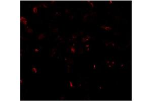 Immunofluorescence of TFEB in human lung tissue with TFEB antibody at 20 μg/mwith TFEB antibody at 2 µg/ml (TFEB anticorps  (N-Term))