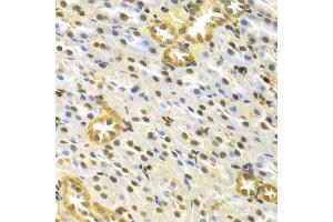 Immunohistochemistry (IHC) image for anti-Tumor Protein P63 (TP63) (AA 421-680) antibody (ABIN3023012)