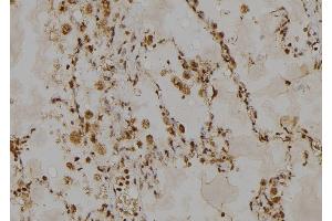 ABIN6268885 at 1/100 staining Human lung tissue by IHC-P. (HSPH1 anticorps  (C-Term))