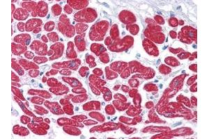 Immunohistochemical analysis of paraffin-embedded human Heart tissues using MYL3 antibody. (MYL3/CMLC1 anticorps)