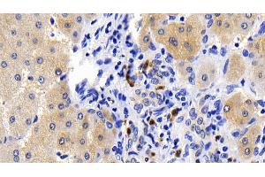 Detection of CASP1 in Human Liver Tissue using Polyclonal Antibody to Caspase 1 (CASP1) (Caspase 1 anticorps  (AA 120-297))