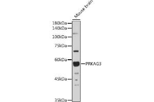 Western blot analysis of extracts of Mouse brain, using PRK antibody (ABIN6129909, ABIN6146189, ABIN6146191 and ABIN6218391) at 1:1000 dilution. (PRKAG3 anticorps  (AA 1-210))