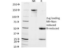 SDS-PAGE Analysis Purified CD56 Mouse Monoclonal Antibody (NCAM1/795). (CD56 anticorps)