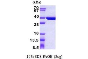 SDS-PAGE (SDS) image for Sulfotransferase Family, Cytosolic, 1C, Member 4 (SULT1C4) (AA 1-302) protein (His tag) (ABIN5852985)