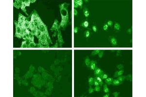 Immunofluorescence staining for p38 MAPK (pT180/pY182) (right figure). (MAPK14 anticorps  (pThr180))