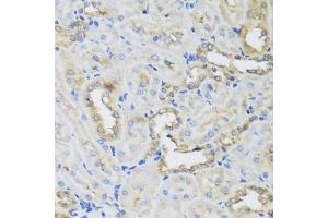 Immunohistochemistry of paraffin-embedded rat kidney using AHCYL1 antibody (ABIN5975313) at dilution of 1/100 (40x lens).