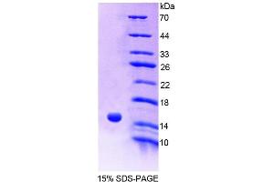 Image no. 1 for Acylphosphatase 2, Muscle Type (Acyp2) (AA 2-99) protein (His tag) (ABIN6239073) (Acyp2 Protein (AA 2-99) (His tag))
