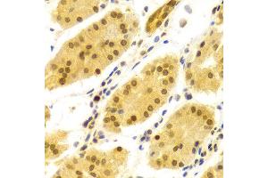 Immunohistochemistry of paraffin-embedded Human gastric using ELAVL1 antibody at dilution of 1:100 (x400 lens).