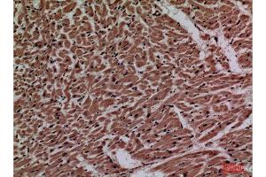 Immunohistochemistry (IHC) analysis of paraffin-embedded Human Heart, antibody was diluted at 1:100.