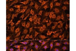 Immunofluorescence analysis of C6 cells using ERK1 / ERK2 Polyclonal Antibody at dilution of 1:100. (ERK1/2 anticorps)