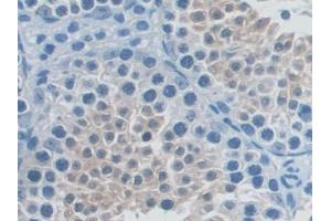 DAB staining on IHC-P; Samples: Mouse Testis Tissue (TNFRSF11A anticorps  (AA 359-542))