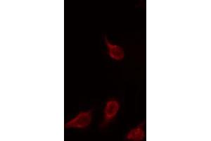 ABIN6266925 staining HuvEc by IF/ICC. (EIF3L anticorps  (N-Term))