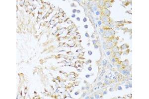 Immunohistochemistry of paraffin-embedded Rat testis using DDX3Y Polyclonal Antibody at dilution of 1:100 (40x lens). (DDX3Y anticorps)