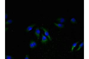 Immunofluorescent analysis of A549 cells using ABIN7161422 at dilution of 1:100 and Alexa Fluor 488-congugated AffiniPure Goat Anti-Rabbit IgG(H+L) (NPBWR2 anticorps  (AA 1-45))