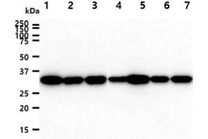The cell lysates (40ug) were resolved by SDS-PAGE, transferred to PVDF membrane and probed with anti-human PPIE antibody (1:1000). (PPIE anticorps)