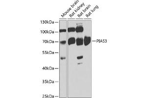 Western blot analysis of extracts of various cell lines, using PI antibody (ABIN6128452, ABIN6145599, ABIN6145601 and ABIN6222851) at 1:1000 dilution. (PIAS3 anticorps  (AA 452-628))