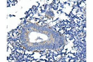 IHC analysis of SYP using anti-SYP antibody (ABIN7603120). (Synaptophysin anticorps  (N-Term))