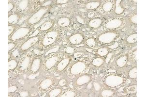 ABIN6262920 and ABIN6277730 at 1/100 staining human normal kidney tissue by IHC-P. (LATS1,2 (Internal Region) anticorps)