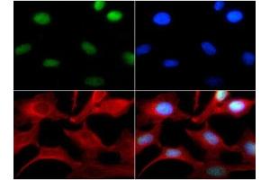 Immunocytochemistry of Rabbit Anti-Histone H3 [Monomethyl Lys4] Antibody. (Histone 3 anticorps  (H3K4me))