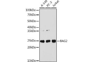 Western blot analysis of extracts of various cell lines, using B antibody (ABIN7265849) at 1:1000 dilution. (BAG2 anticorps)