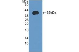 Detection of Recombinant LEAP2, Human using Polyclonal Antibody to Liver Expressed Antimicrobial Peptide 2 (LEAP2) (LEAP2 anticorps  (AA 23-76))