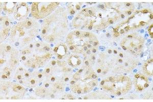 Immunohistochemistry of paraffin-embedded Mouse kidney using CSNK2A1 Polyclonal Antibody at dilution of 1:100 (40x lens). (CSNK2A1/CK II alpha anticorps)