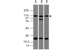 Image no. 1 for anti-NLR Family, Pyrin Domain Containing 2 (NLRP2) (AA 850-1060) antibody (ABIN5027383) (NLRP2 anticorps  (AA 850-1060))
