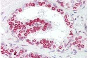 Anti-GATA4 antibody IHC staining of human prostate. (GATA4 anticorps  (AA 330-380))