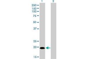 Western Blot analysis of CETN1 expression in transfected 293T cell line by CETN1 monoclonal antibody (M01), clone 2A6.