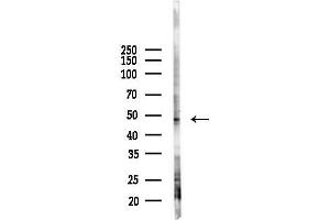 anti-gamma-aminobutyric Acid (GABA) A Receptor, pi (GABRP) (N-Term) antibody