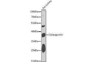 Western blot analysis of extracts of Rat kidney, using Osteopontin antibody (ABIN6132294, ABIN6148378, ABIN6148380 and ABIN6218573) at 1:1000 dilution. (Osteopontin anticorps  (AA 106-205))