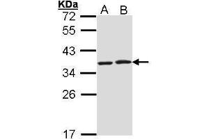 WB Image Sample (30 ug of whole cell lysate) A: Molt-4 , B: Raji 12% SDS PAGE antibody diluted at 1:1000