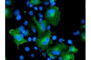 Immunofluorescence (IF) image for anti-Cerebral Cavernous Malformation 2 (CCM2) antibody (ABIN1497136) (CCM2 anticorps)