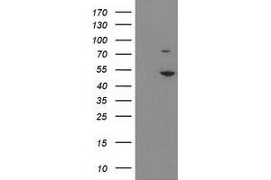 Western Blotting (WB) image for anti-Eukaryotic Translation Initiation Factor 2B, Subunit 3 Gamma, 58kDa (EIF2B3) antibody (ABIN1497969)