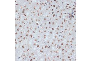 Immunohistochemistry of paraffin-embedded rat liver using Phospho-CDK1-Y15 antibody (ABIN3019442, ABIN3019443, ABIN3019444 and ABIN6225371) at dilution of 1:100 (40x lens). (CDK1 anticorps  (pTyr15))