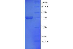 UQCRQ Protein (AA 2-78, partial) (GST tag)